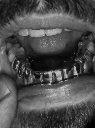 Grillz Lower bottom Full Set
