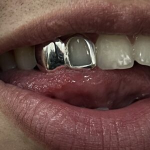 Grillz Full + Open Combo